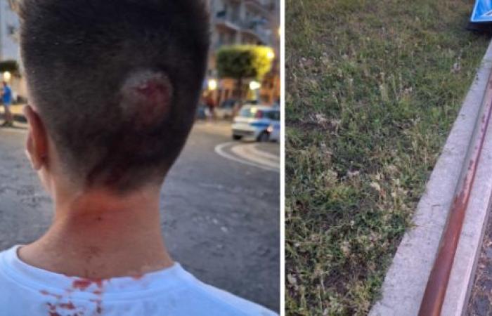Junger Mann durch Schildmast am Hinterkopf verletzt – Il Meridiano News