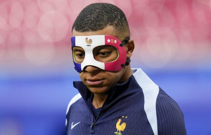 Die Maske mit der französischen Trikolore, die Kylian Mbappé nach einem Nasenbruch beim Training trug