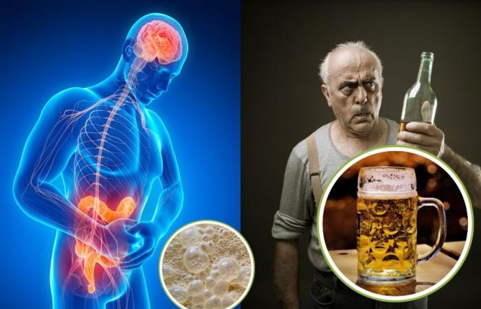 Diese seltene Krankheit führt dazu, dass man sich betrinkt, ohne zu trinken: Der mysteriöse Fall des Intestinalen Fermentationssyndroms (ABS)