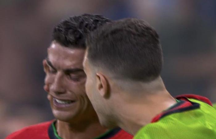 EM 2024, Cristiano Ronaldo verschoss den (ersten) Elfmeter gegen Slowenien und bricht in Tränen aus. Doch Diogo Costa schleppt Portugal ins Viertelfinale – Das Video