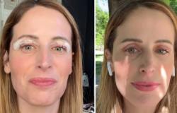 Clio MakeUp zeigt ihre Augen nach der Entfernung der Blepharoplastie-Fähte: Anschauen – Gossip.it