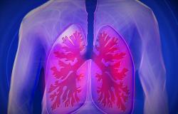 Atemwegserkrankungen nehmen zu, Lungenärzte in Parma zur Regionalkonferenz