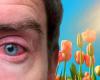 Empfindliche Augen im Frühling: Hier sind die natürlichen Heilmittel gegen die Beschwerden