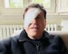 Gianni Morandi postet ein Foto mit auffälliger Augenklappe: Was ist passiert?