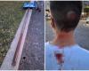 In Pozzuoli löst sich ein Schildmast und trifft ein Kind auf den Kopf. Beinahe-Tragödie