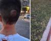 Junger Mann durch Schildmast am Hinterkopf verletzt – Il Meridiano News